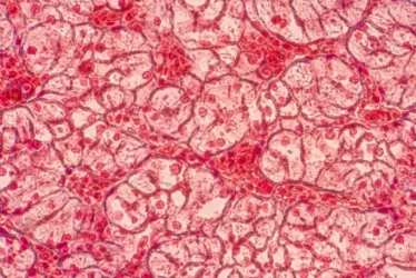 What is Altered intercellular communication and how to counter it! 1 shutterstock 1071089975 1 jpg